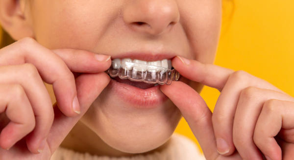 Image of a woman holding a clear orthodontic aligner up to her mouth