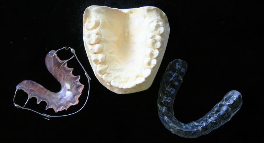 A image of two different kinds of orthodontic retainers with a tooth model in between them