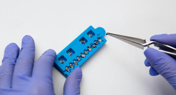 An orthodontist holding a blue box filled with self-ligating braces