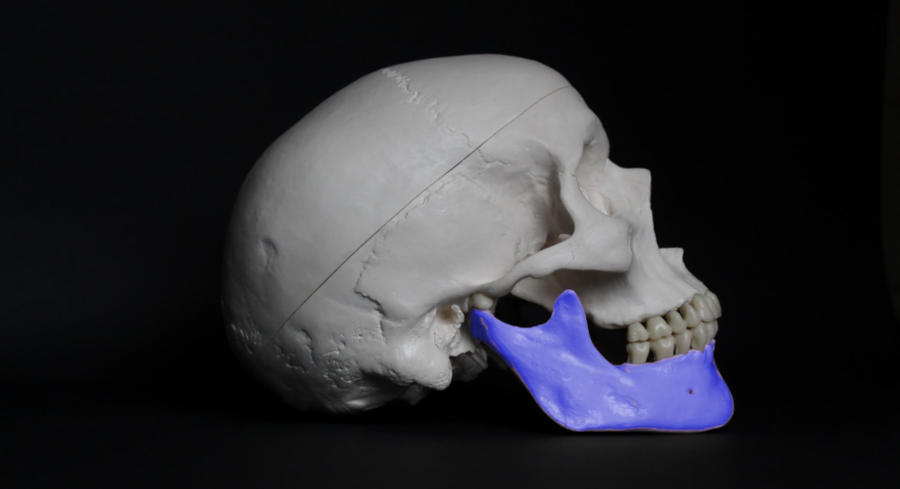 A human jaw highlighting the TMJ joint in purple
