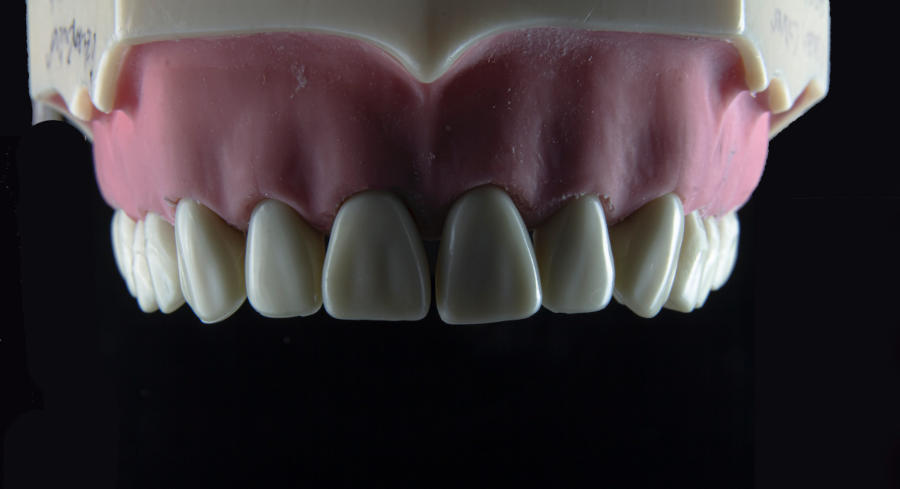 A tooth model of perfectly straight teeth on a dark background